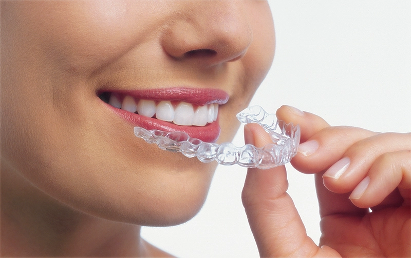 Teeth Whitening
